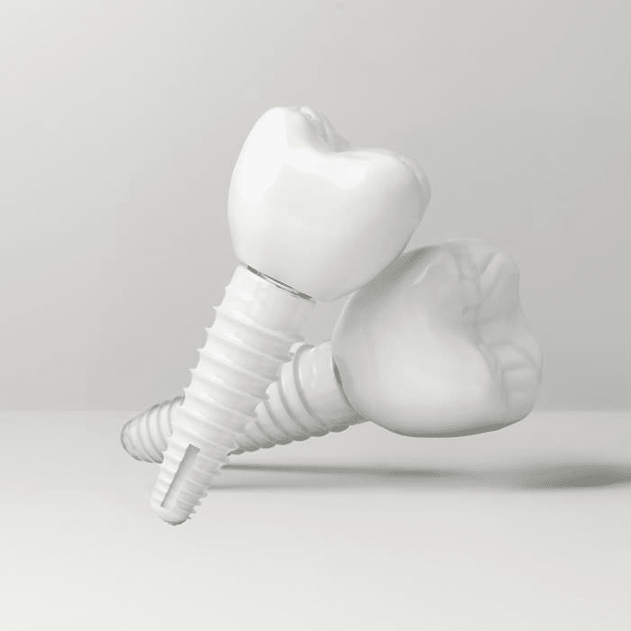 Keramikimplantate